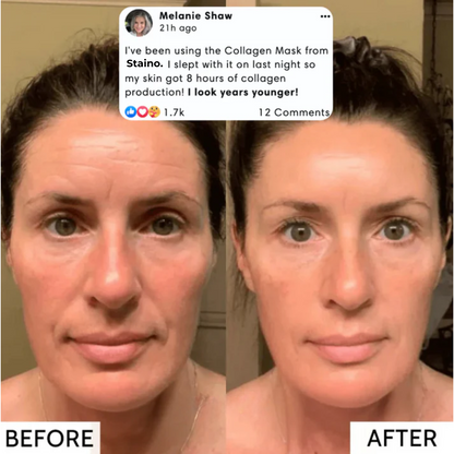 Staino™ - GlassGlow Collagen Mask